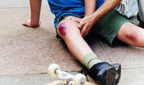 Как да развиете коляно след травма