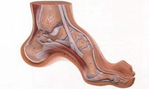Причини, симптоми, методи на лечение и възстановяване в случай на пареза на крака