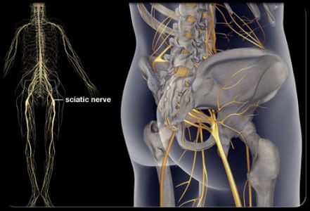 Симптоматика, диагностика и методи за лечение на възпаление на сиатски нерви