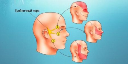 Симптоми и методи за лечение на възпаление на тригеминалния нерв