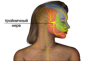 Невралгия на тригеминалния нерв: лицева болест и методи за нейното лечение