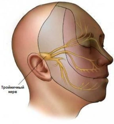 Симптоми на възпаление на тригеминалния нерв и успешното му лечение