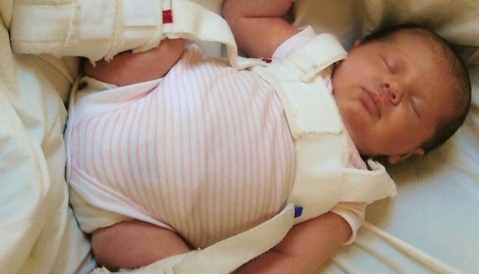 Незрялостта на тазобедрената става при новородени