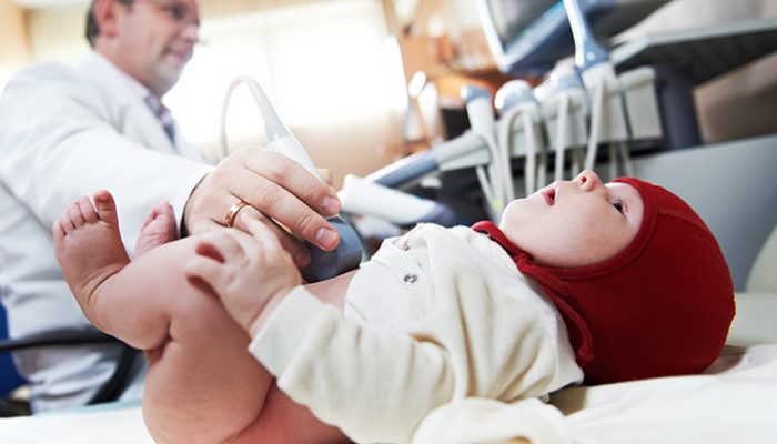 Вродено дислокация на тазобедрената става и тазобедрена дисплазия при новородени