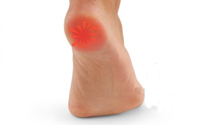 Болка в краката при ходене: причини и лечение