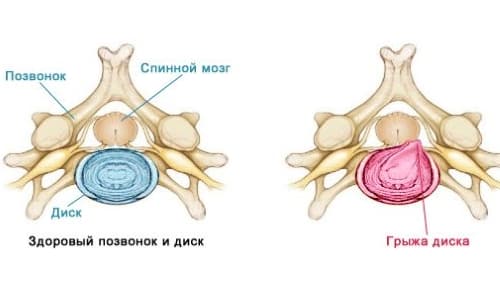 Как и как се показва рентгеновото изображение на цервикалната гръбнака?