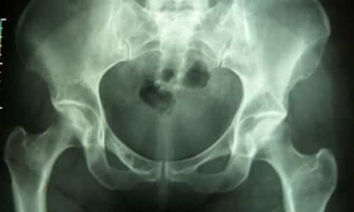 Как да направите и как да се подготвите за рентгеновото изследване на гръбначния стълб?