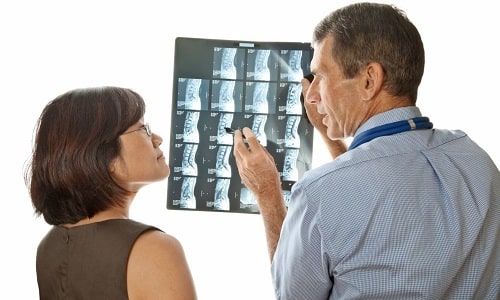 Какво е по-добро и по-информативно от CT или ЯМР на гръбначния стълб?