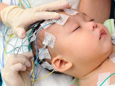 Какво показва ЕЕГ процедурата на мозъка при деца и възрастни, тълкуването на резултатите