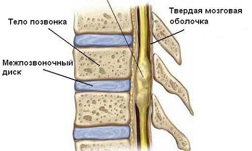 Причини, симптоми и лечение на тумори на гръбначния мозък