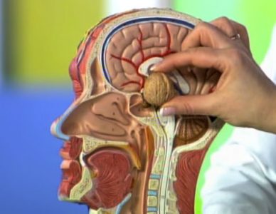 Симптоми, лечение и последствия от аденома на хипофизната жлеза на мозъка