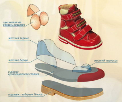 Как да изберем подходящите ортопедични обувки за дете?