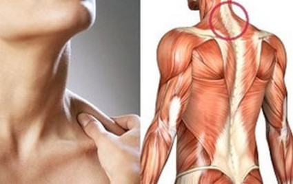 Какво може да прояви миозит на различни мускулни групи