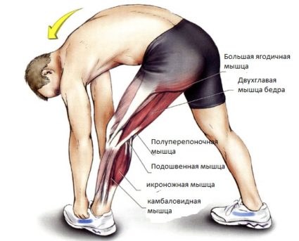 Причини за болка в мускулите на телетата