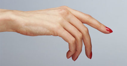 Как да се лекува деформацията на ставите на пръстите