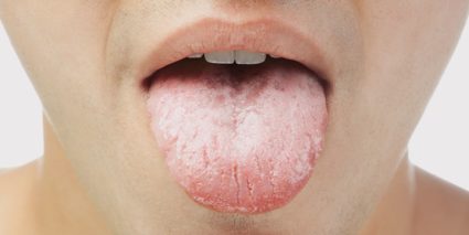 Какъв е глоситът на езика и как да се лекува?