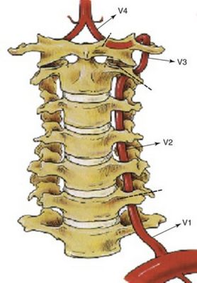 Артерия в гръбначния стълб