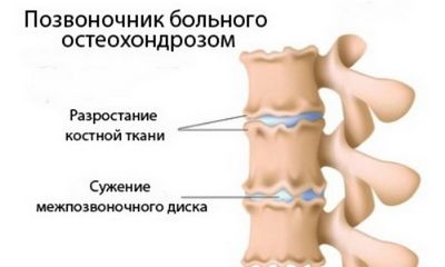 Зареждане на гръбначния стълб