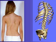 Болести на гръбначния стълб