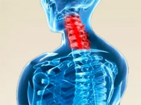 Едноклетъчна артроза на гръбначния стълб какво е това?