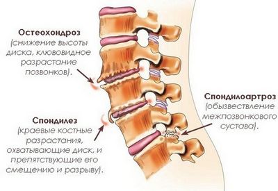 Какво представлява гръбначният стълб на гръбначния стълб?