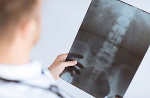 Как да разпознаете остеохондрозата: рентгенова снимка или ЯМР