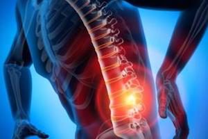 Защо остеохондрозата на гръбнака навреди на червата: ние търсим причинно-следствена връзка