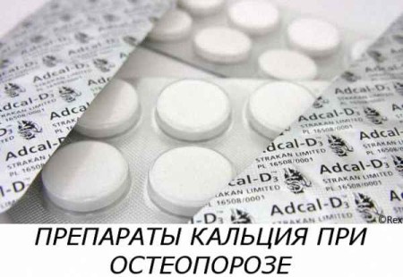 Калциеви препарати (таблетки, лекарства) за лечение и профилактика на остеопороза
