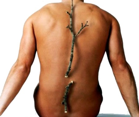 Причини, лечение и профилактика на остеопорозата при мъжете