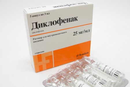 Противовъзпалително при остеохондроза: диклофенак, кеталон, мелоксикам, мовалис, ибупрофен