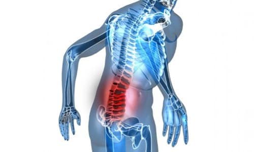 Анатомия, структура и концепция за остеохондроза на лумбалния гръбначен стълб