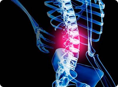 Как да различаваме болката в гърба от бъбречната болка