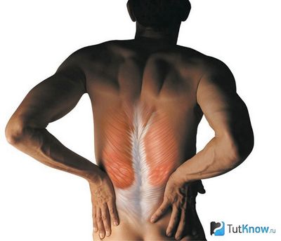 Спорт и болки в гърба