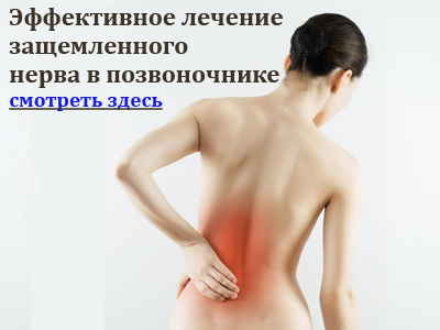 Какъв лекар за болки в гърба?