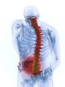 Блокада в лумбалния гръбначен стълб