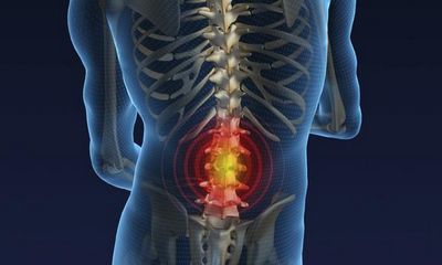 Дегенеративни дистрофични промени в лумбалния гръбнак