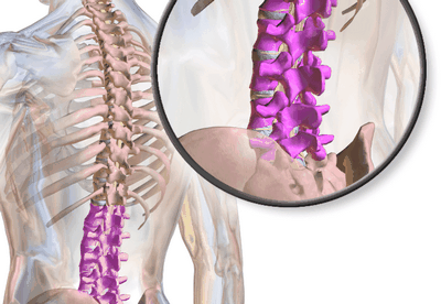 Управление на гръбначния стълб на лумбалния гръбначен стълб