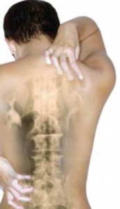 Остеохондроза на гръбначния стълб на гръдния кош