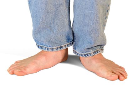 Как може да бъде излекувана плоската стъпала?