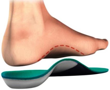 Трансферни плоски стъпала: основните симптоми и начини на лечение
