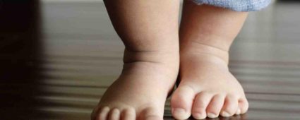 Лечение на плоски крака при детето