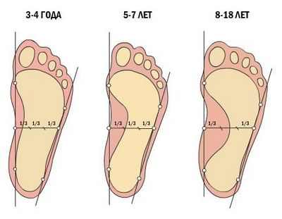 Характеристики на лечението на плоски крака в детето