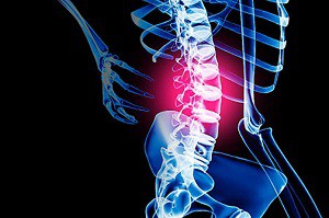 Признаци, профилактика, лечение на остеохондроза на лумбалния гръбначен стълб
