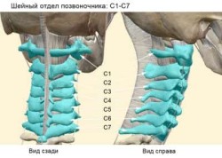Нестабилност на гръбначните прешлени в гръбначния стълб: причини, симптоми и лечение