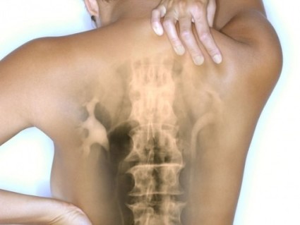 Остеохондроза на цервикалния гръбначен стълб и лечението му с народни средства