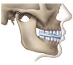 Temporomandibular joint: неговата структура, функции и заболявания
