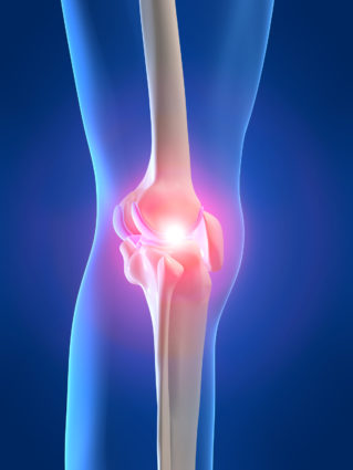 Артрит на колянната става: симптоми и лечение