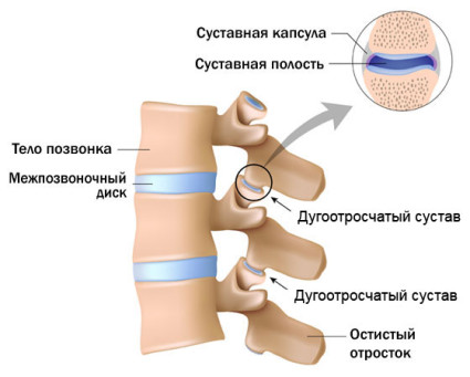 Артроза и лечение според Evdokimenko