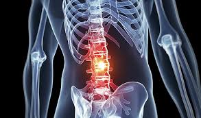 Чести причини за тежка болка в гърба и основни признаци