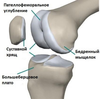 Степени и лечение на пателофрамална артроза на колянната става